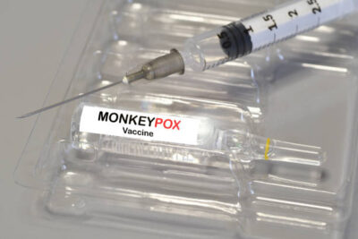Clinical features and management of human monkeypox: a retrospective observational study in the UK