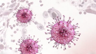 How I treat resistant cytomegalovirus infection in hematopoietic cell transplantation recipients