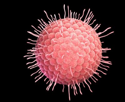 Updated Guidance: Guidance for issuing varicella-zoster immunoglobulin (VZIG)